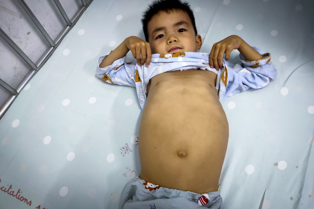 湖南8岁男孩体重仅40斤,小伙4岁失去双臂父亲精神失常