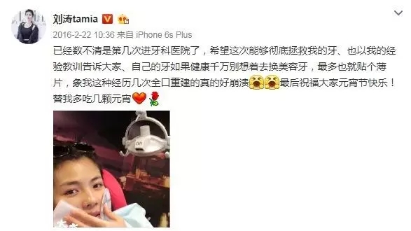 刘涛是全口瓷牙,演员刘涛的一口烤瓷牙多少钱