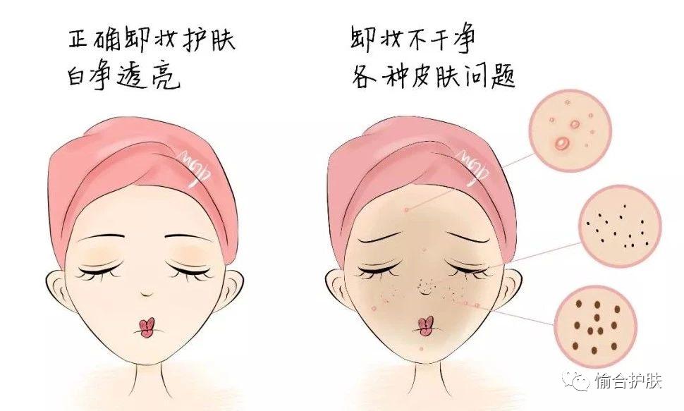 什么是血丝病,怎么辨别红血丝