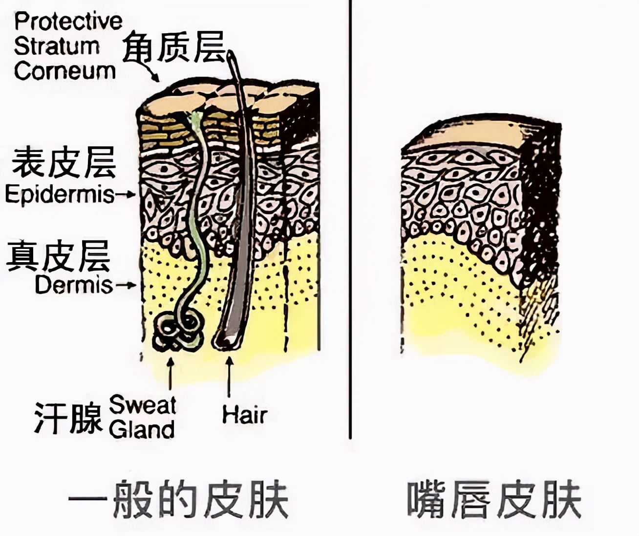 多喝水嘴唇还是干裂起皮怎么办,嘴唇干燥起皮反反复复