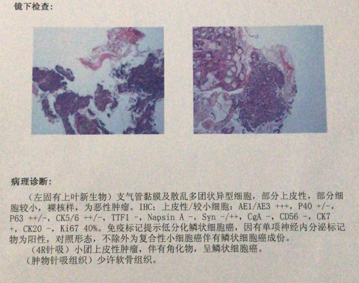 仅1年生存期？我带父亲去麻省总医院看肺癌，不认命才有生的希望