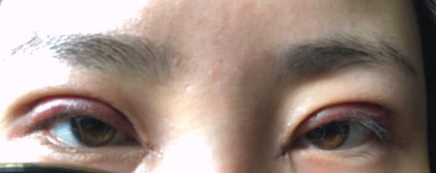 土肥圆怎么逆袭最好,土肥圆的逆袭效果