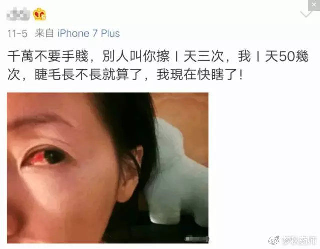 哪种治疗青光眼的药可以增长睫毛,青光眼眼药水促进睫毛生长哪款好