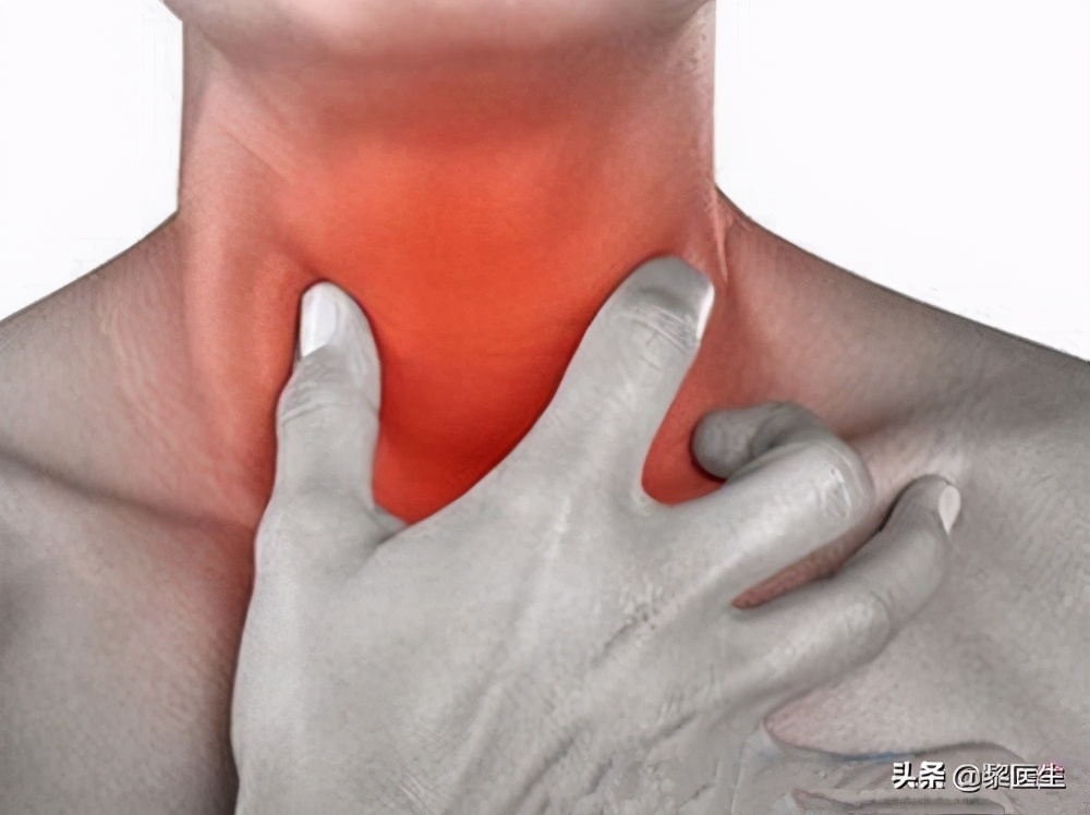 咽喉炎长期不治得了喉癌全喉切除,早期喉癌会误诊为声带息肉吗