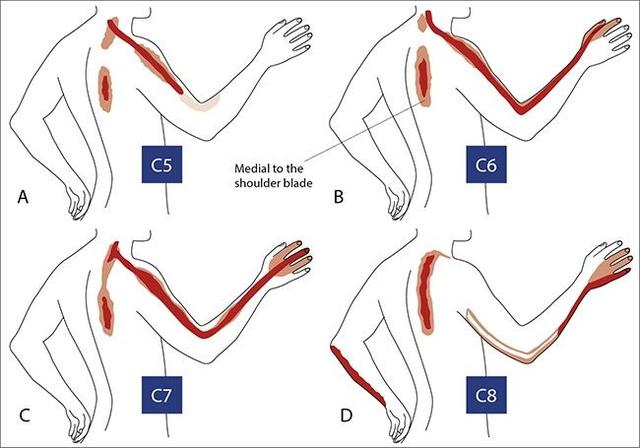 常见麻木病因和治疗方法,手部麻木的7种常见病因