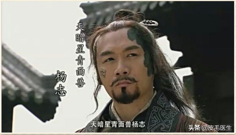 梁山好汉个人问题怎么解决,梁山好汉的通病