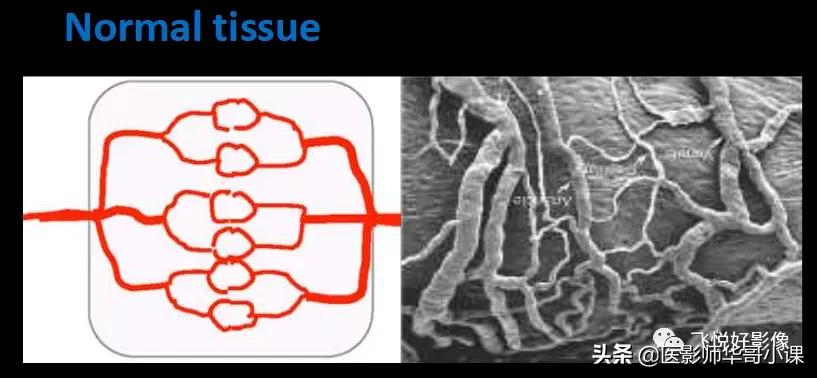 飞利浦磁共振系统界面及操作流程,飞利浦磁共振技术学习