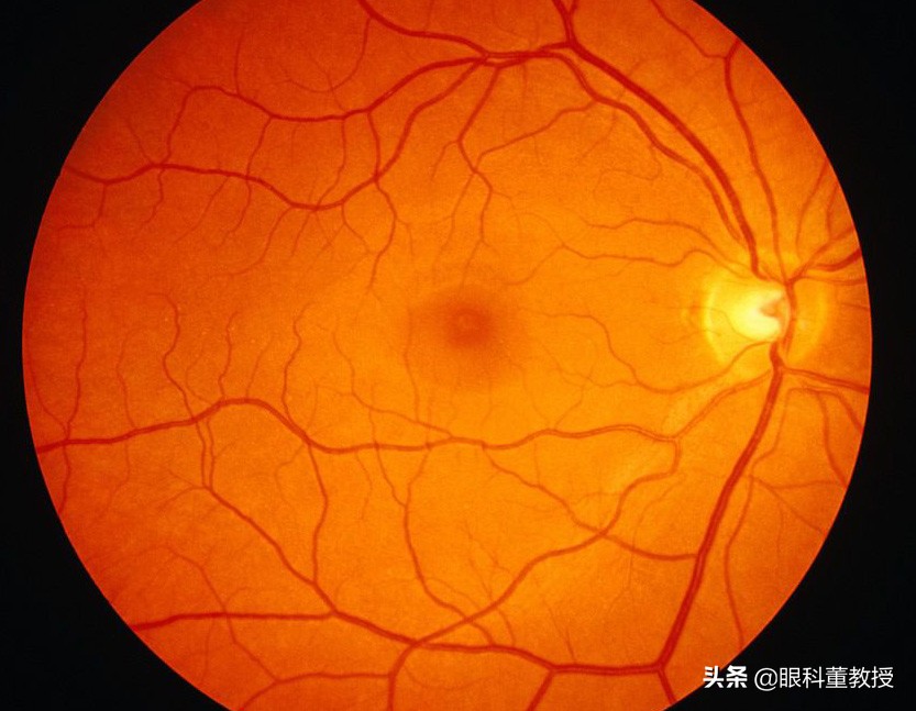 老人眼底视力模糊怎么办,老人视网膜脱落怎么恢复视力