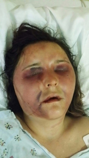 美国被殴打致死的女孩,华裔女子被丈夫殴打致死