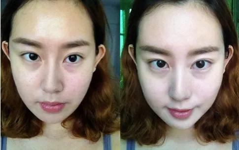 去螨虫慕斯推荐,洗面奶慕斯去螨虫