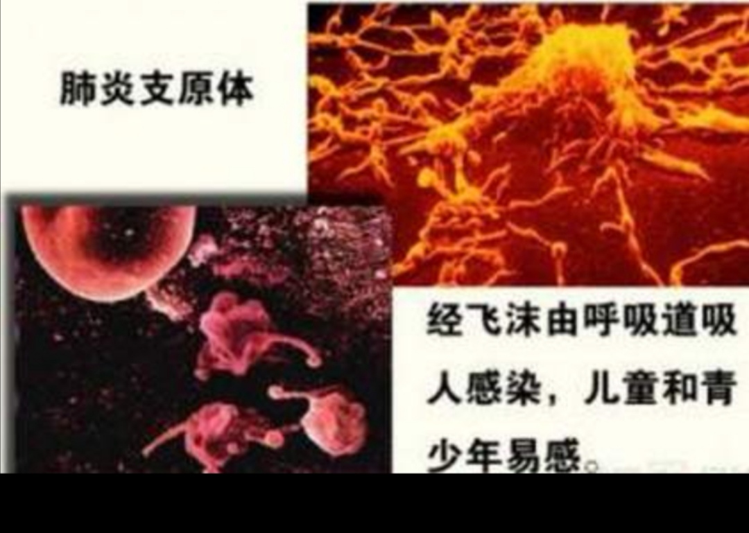 儿童肺炎支原体感染的症状和表现,宝宝肺炎支原体感染最有效的方法