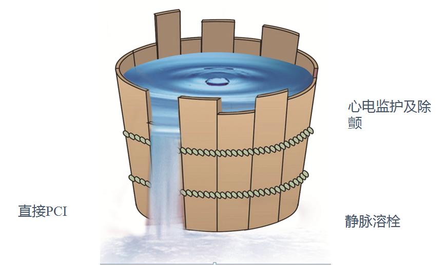 急性心肌梗死的做法,内科主治心肌梗死视频
