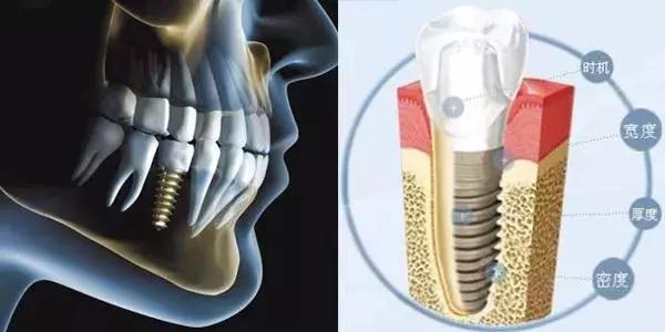 牙齿公益广告,2021年缺失牙公益援助行动