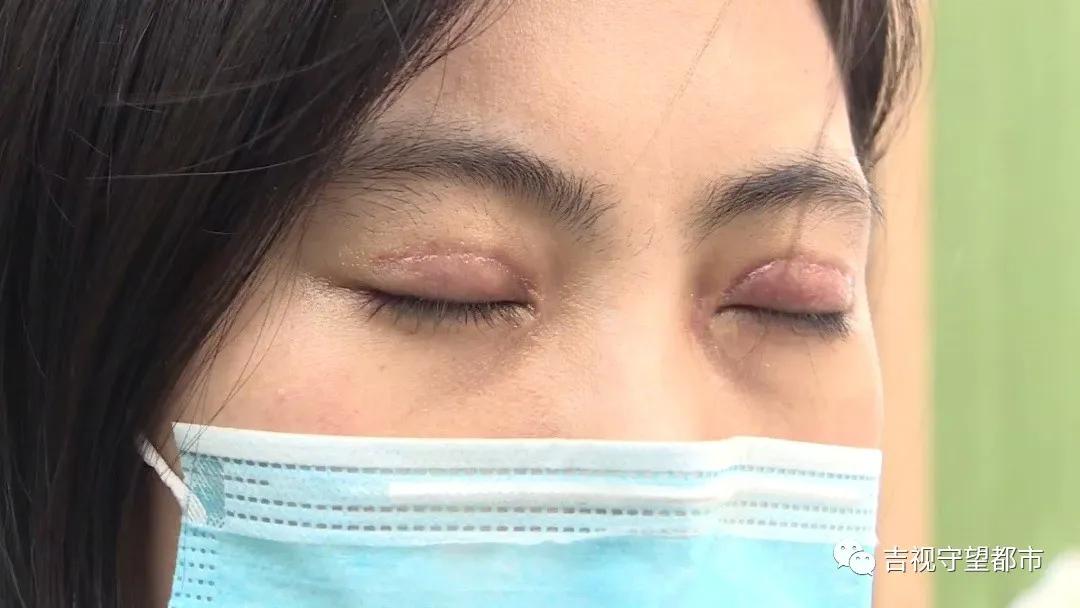 公寓做双眼皮效果好吗,公寓双眼皮