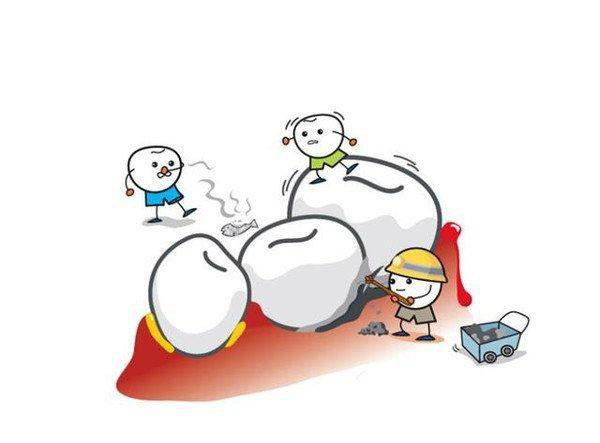 预防牙周病有效的方法,预防牙周病的十种方法