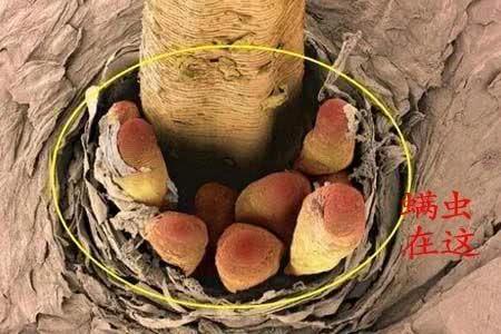 床上螨虫成窝,家里老人小孩老过敏,教你1个土法子,让螨虫消失