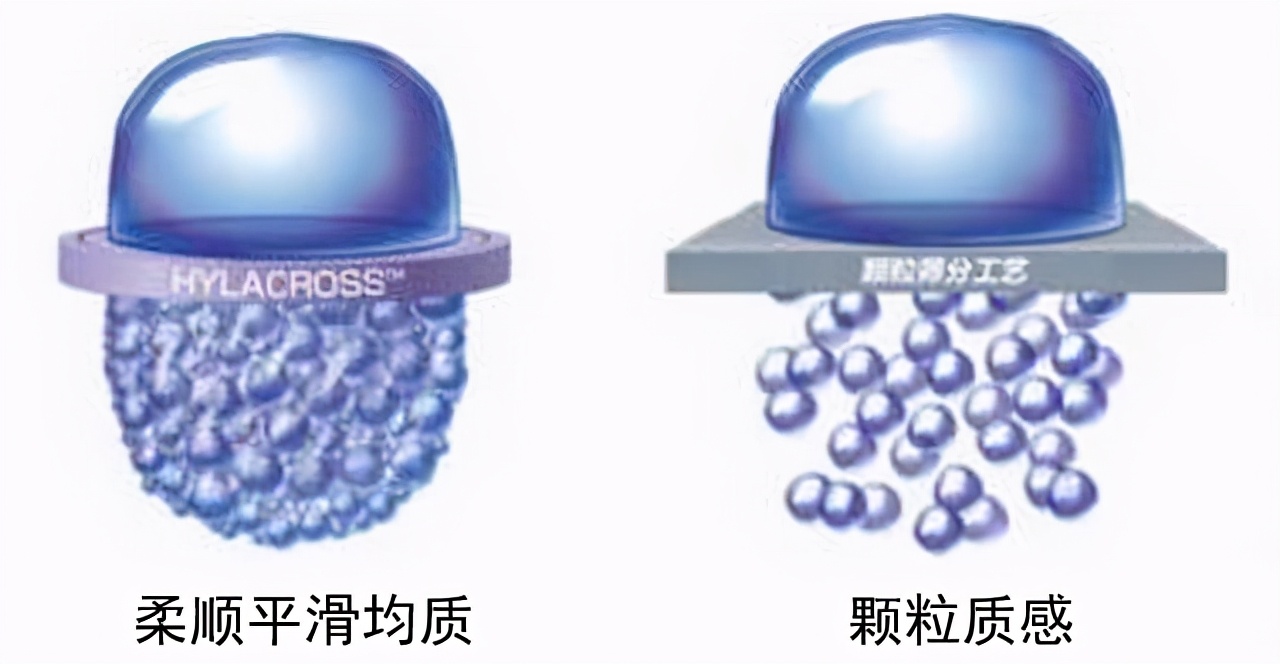 艾尔建旗下玻尿酸有哪些品牌,可以喝的玻尿酸是什么品牌