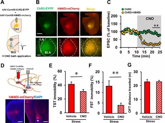 国外有效治疗抑郁症的方法,国际上治疗抑郁症最新办法