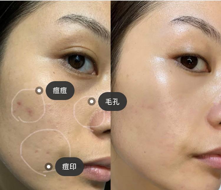 贝嫂维多利亚整鼻子了吗,贝嫂维多利亚化妆视频