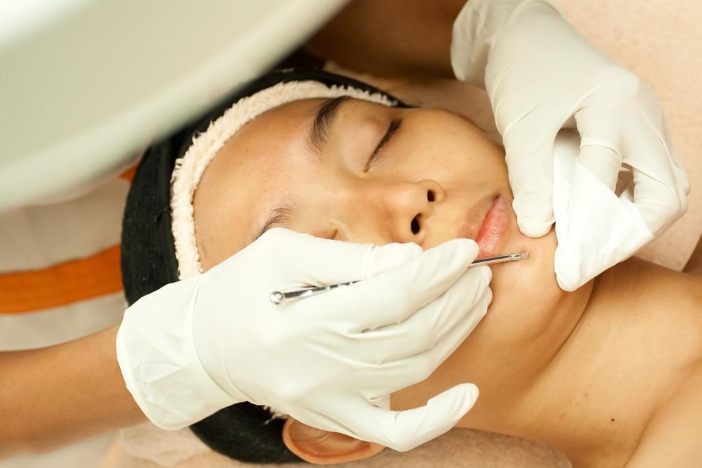 黑头怎么去除简单方法学生,自己挤黑头粉刺的正确方法