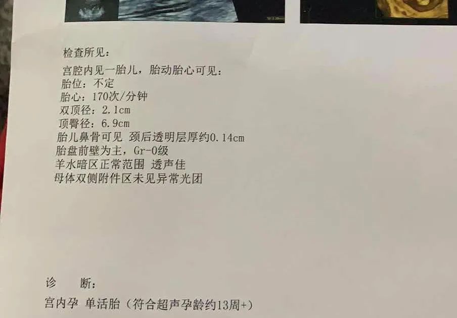 孕期复查胎儿侧脑室宽做什么b超,孕期一般做几个b超