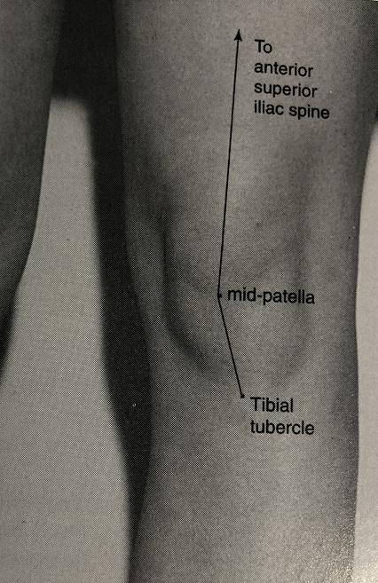 膝盖附近疼是髌骨软化症引起的吗,髌骨膝前疼痛综合症