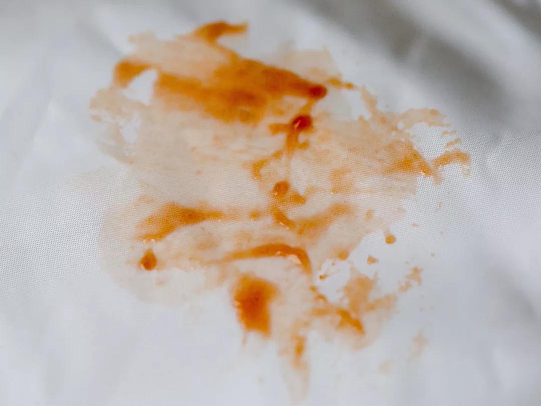 羽绒服脏了直接用毛巾擦可以吗,白色羽绒服特别脏干洗店能搞定吗