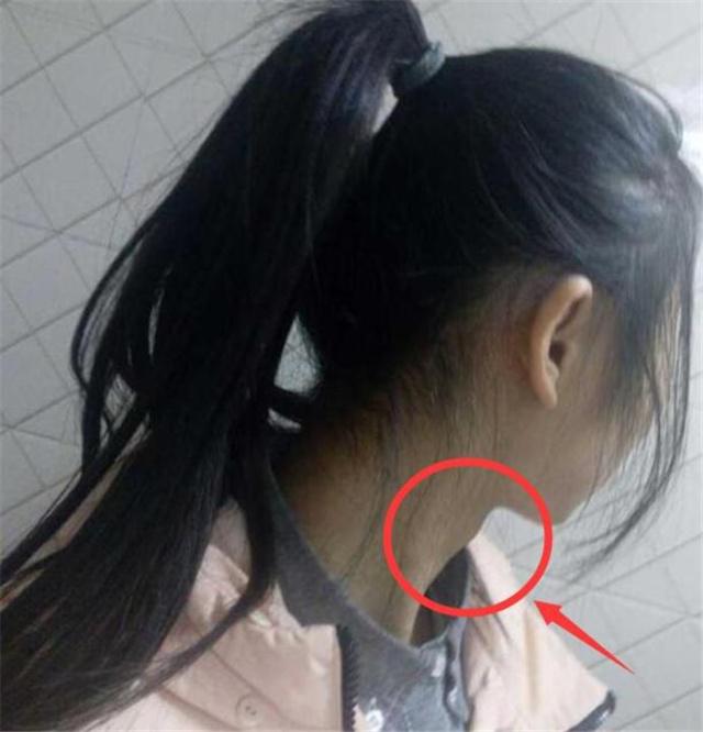 12岁长出喉结胡子正常吗,13岁女孩长喉结正常吗
