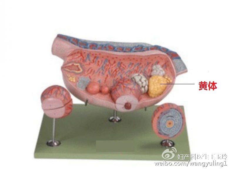 *生活性**后腹痛,原来是黄体破裂惹的祸