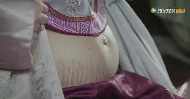 长妊娠纹了怎么办,哺乳期胸上长妊娠纹怎么办