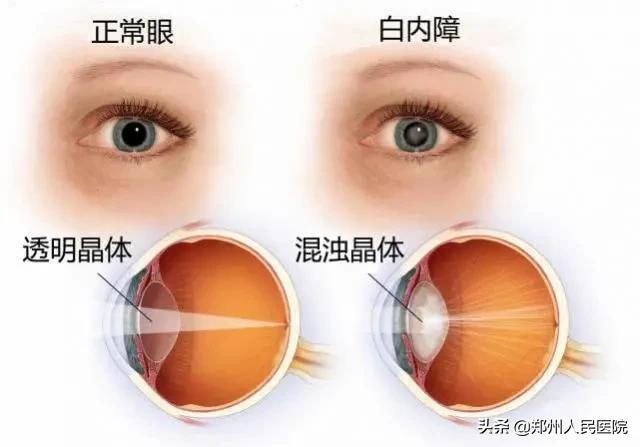 戳这里→让你告别模糊，看清世界