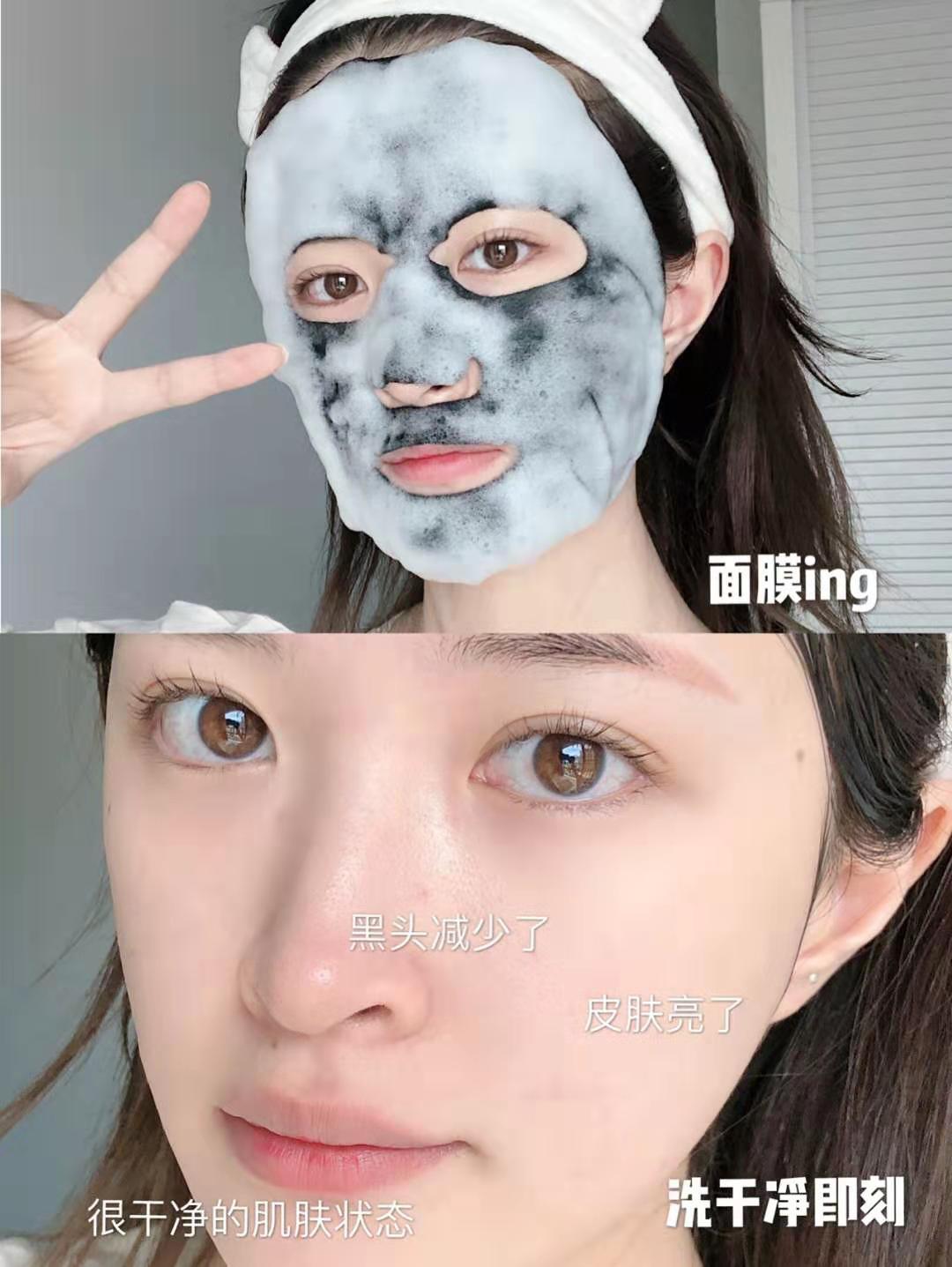 混油敏感肌肤日常怎么护肤,三十岁混油敏感肌护肤产品