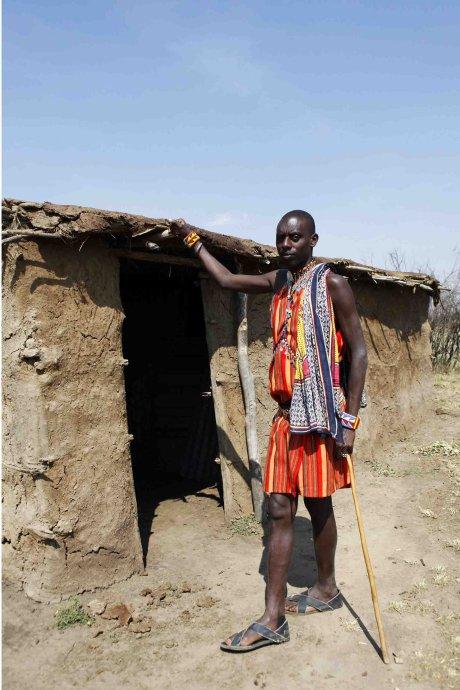 非洲有一种“寄生虫”,能钻到人脚底,小伙脚底被钻出很多个洞