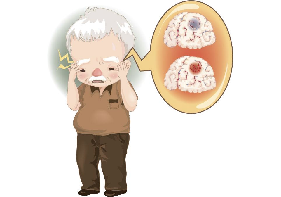 中风面瘫嘴歪眼斜怎么治疗,嘴歪眼斜是面瘫吗怎么治