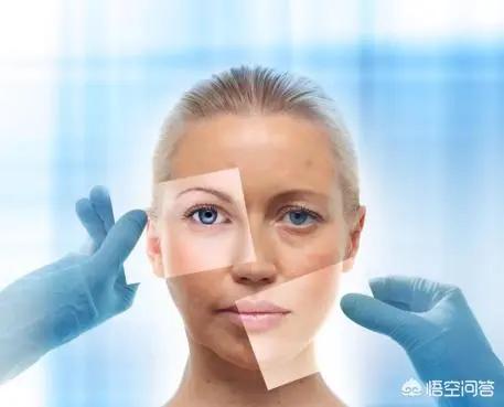 改善皮肤粗糙暗黄毛孔粗大,皮肤油毛孔粗大暗黄用什么护肤品