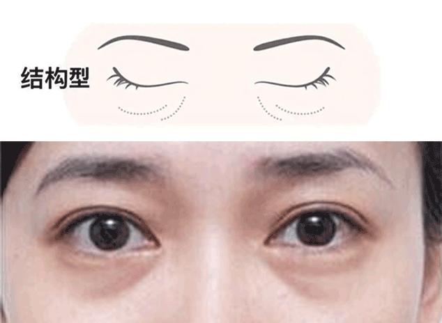 无效遮瑕测评,无效遮脸