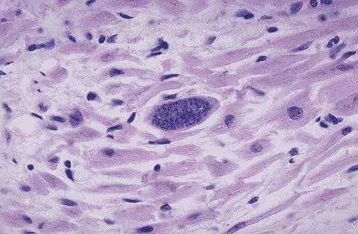 猫咪身上的寄生虫怎么处理,按时驱虫的猫咪还会有寄生虫吗