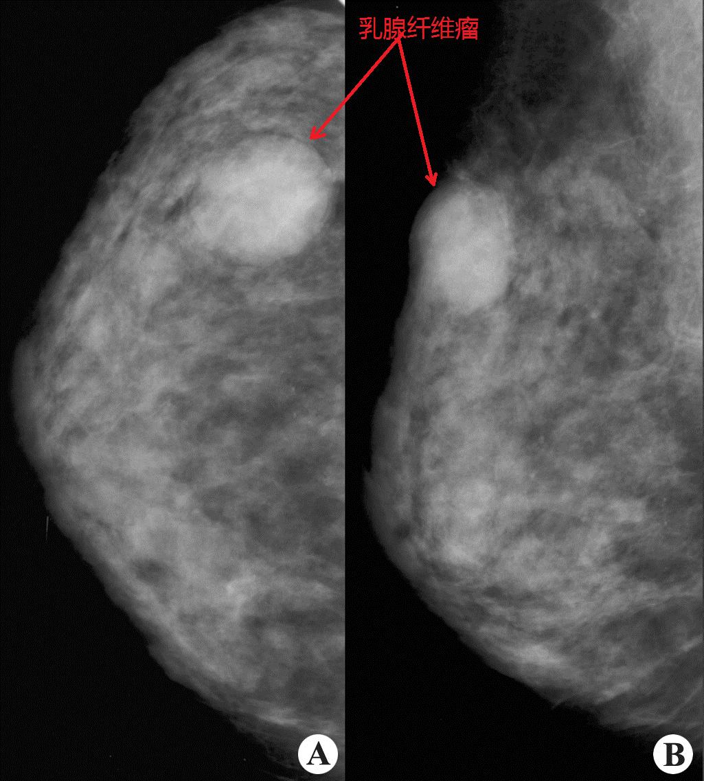 什么是癌症病理学,什么是癌症中医治疗