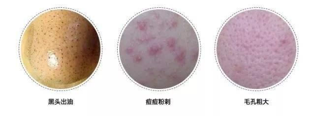 洗面奶选哪种才好,洗面奶不贵的能用吗