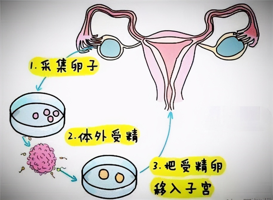 女性得了结核,女性有结核能做试管吗