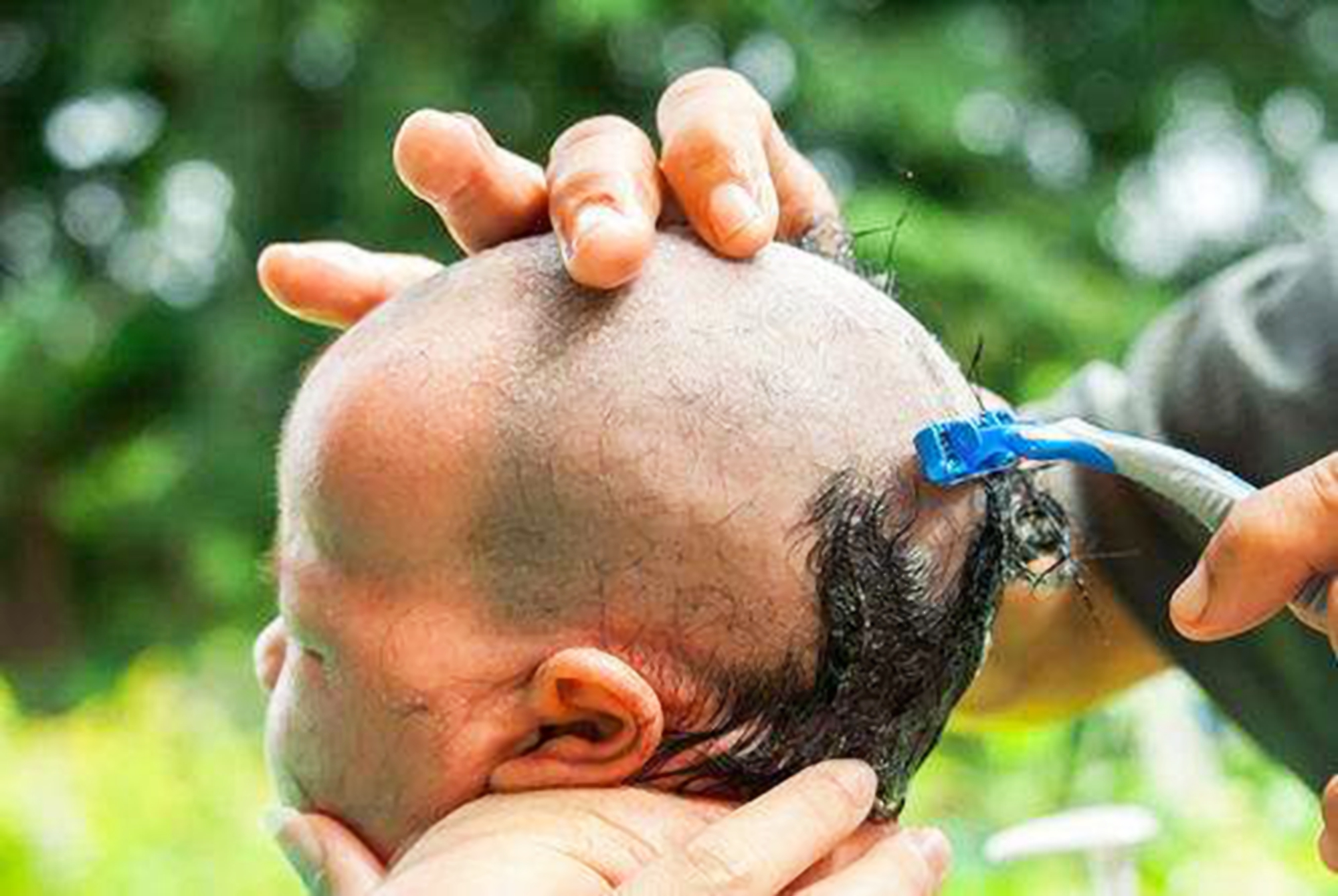 宝宝成为小秃瓢这4个原因要了解,宝宝头发有斑秃是什么原因