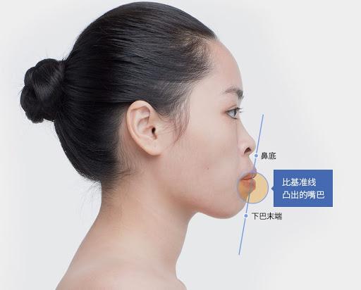 一张嘴毁掉了整张脸,一张嘴毁掉半张脸完整版