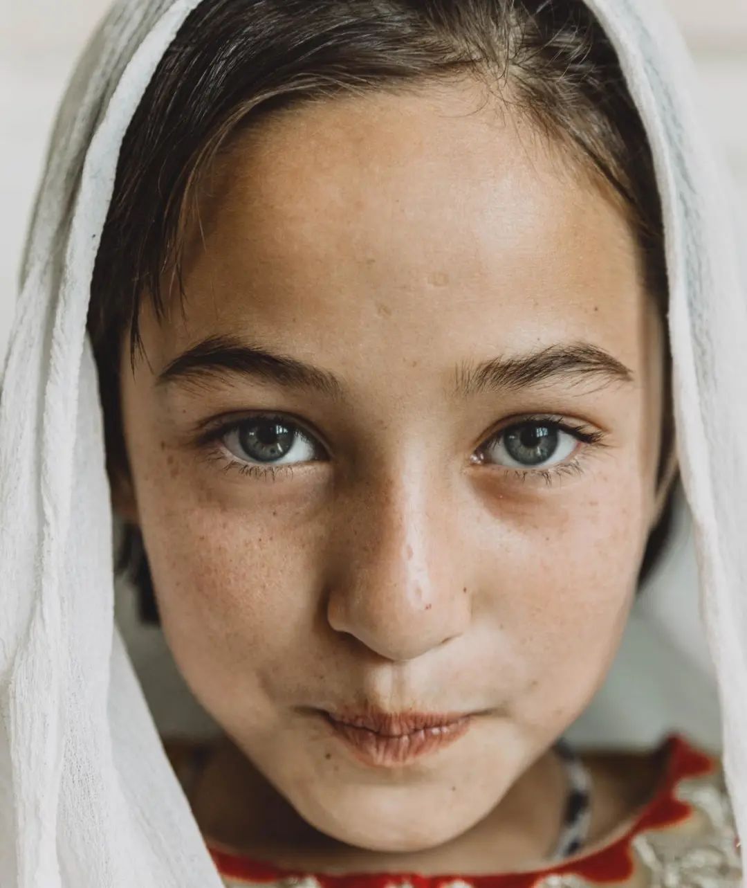 最常遇到的皮肤问题,最让人头疼的皮肤病