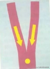 李宁牌肌效贴,李宁肌内效贴儿童