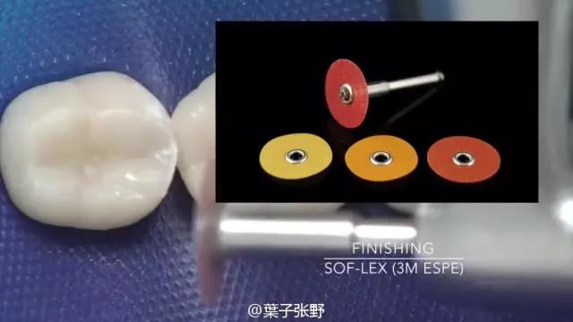 补牙疼吗补牙过程图,补牙全部过程是什么样子的