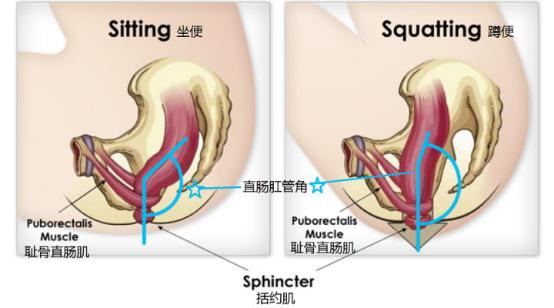 宝宝拉屎便秘哭怎么办,宝宝拉粑粑有点哭闹是怎么回事
