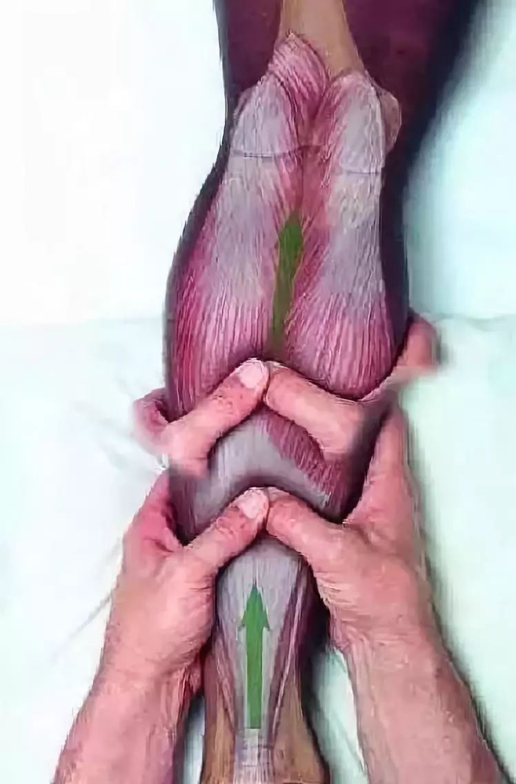 有什么治疗小腿静脉曲张的好方法,小腿静脉曲张的最快消除方法