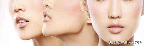 脸型侧边扁平怎么改善,方脸下颌骨宽大怎么改善