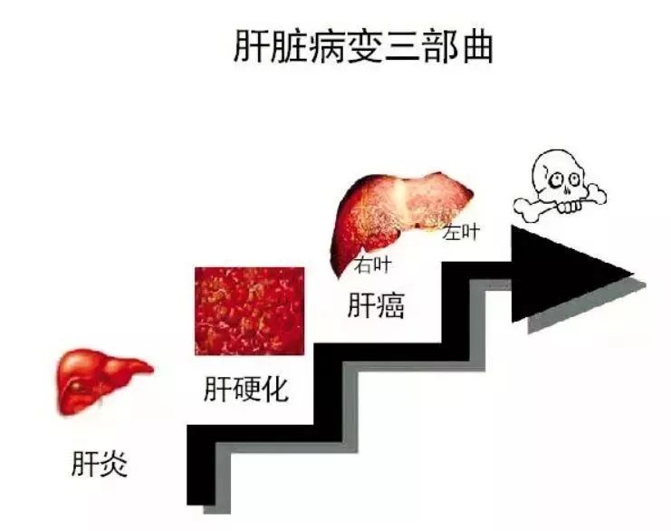 干扰素治愈后会复发吗,干扰素彻底治愈后会复发吗