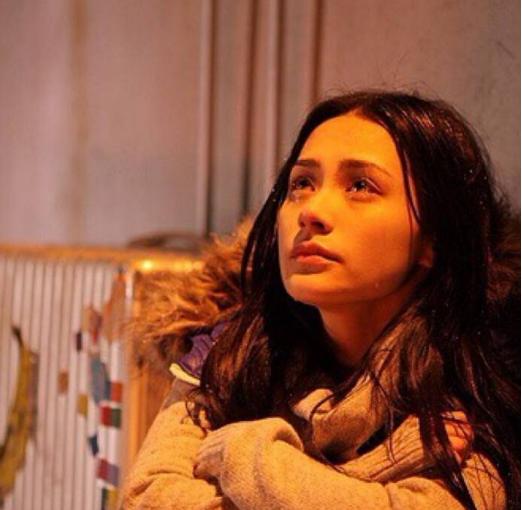 阿娇头部受伤缠绷带照曝光,阿娇受伤后拆绷带首露面